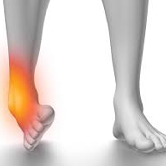 Ankle Sprains Physiotherapy in Surrey