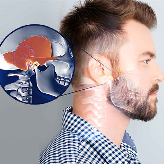 TMJ Treatment in Surrey